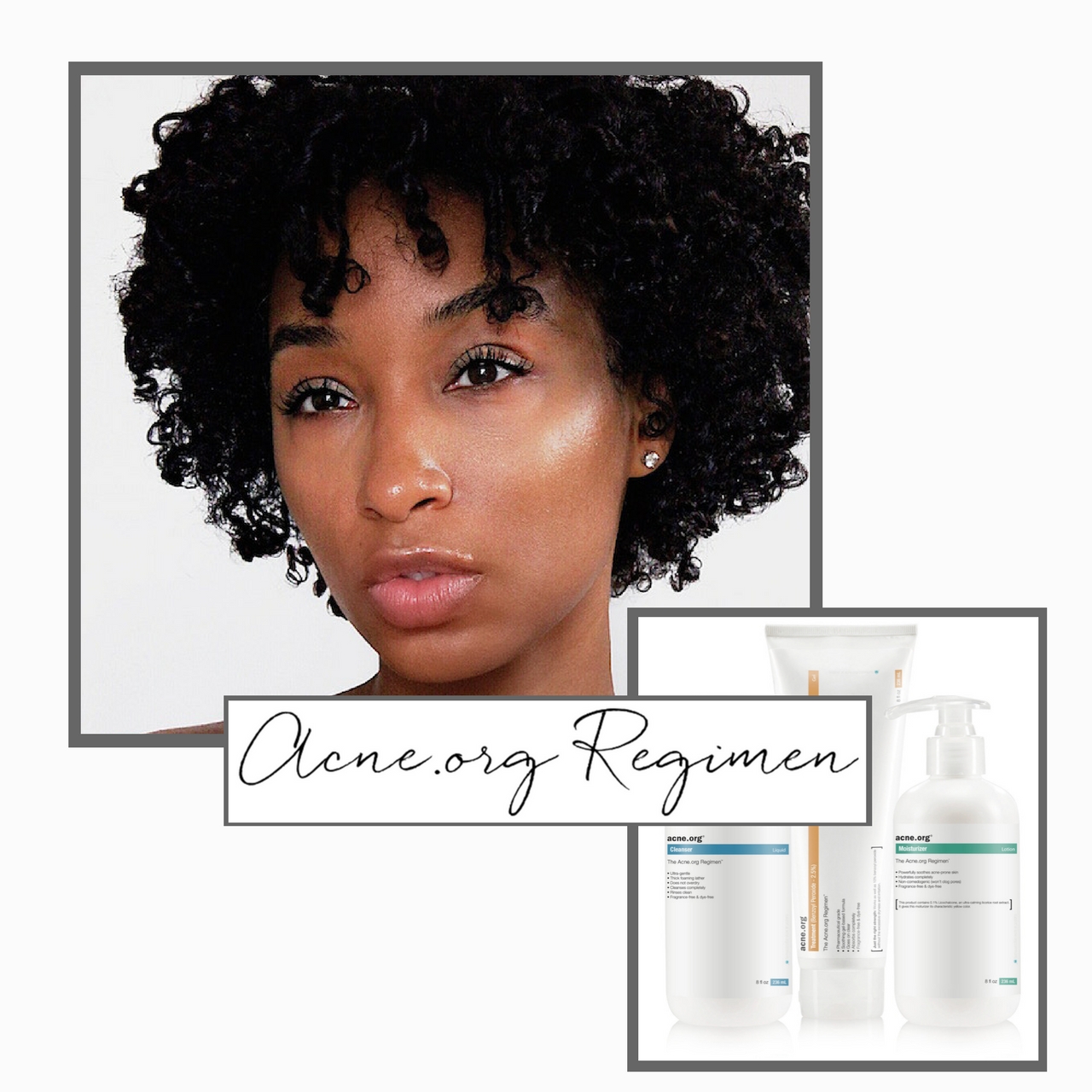 How I cleared up my skin with TIFF BENSON